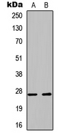 BPIFA1 / SPLUNC1 Antibody - Western blot analysis of PLUNC expression in A549 (A); PC12 (B) whole cell lysates.