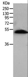 BPIFB2 Antibody - Western blot analysis of Human lung tissue, using BPIFB2 Polyclonal Antibody at dilution of 1:530.