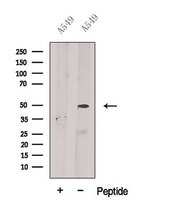 BPIFB2 Antibody - Western blot analysis of extracts of A549 cells using BPIL1 antibody. The lane on the left was treated with blocking peptide.