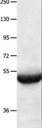 BPIFB3 / C20orf185 Antibody - Western blot analysis of Human lung cancer tissue, using BPIFB3 Polyclonal Antibody at dilution of 1:550.