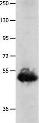 BPIFB3 / C20orf185 Antibody - Western blot analysis of Human lung cancer tissue, using BPIFB3 Polyclonal Antibody at dilution of 1:1600.