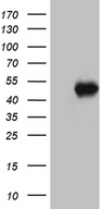 BPOZ / ABTB1 Antibody - HEK293T cells were transfected with the pCMV6-ENTRY control. (Left lane) or pCMV6-ENTRY ABTB1. (Right lane) cDNA for 48 hrs and lysed. Equivalent amounts of cell lysates. (5 ug per lane) were separated by SDS-PAGE and immunoblotted with anti-ABTB1. (1:500)