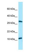 BPY2 Antibody - BPY2 antibody Western Blot of HepG2.  This image was taken for the unconjugated form of this product. Other forms have not been tested.