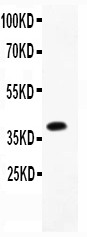BRAF / B-Raf Antibody - All lanes: Anti B Raf at 0.5 ug/ml. WB: Recombinant Human B Raf Protein 0.5ng. Predicted band size: 40 kD. Observed band size: 40 kD.