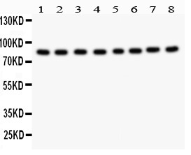 BRAF / B-Raf Antibody - All lanes: Anti B Raf at 0.5 ug/ml. Lane 1: Rat Testis Tissue at 50 ug. Lane 2: Rat Brain Tissue at 50 ug. Lane 3: Mouse Testis Tissue at 50 ug. Lane 4: Mouse Brain Tissue at 50 ug. Lane 5: HeLa Whole Cell Lysate at 40 ug. Lane 6: Jurkat Whole Cell Lysate at 40 ug. Lane 7: MCF-7 Whole Cell Lysate at 40 ug. Lane 8: K562 Whole Cell Lysate at 40 ug. Predicted band size: 84 kD . Observed band size: 84 kD.