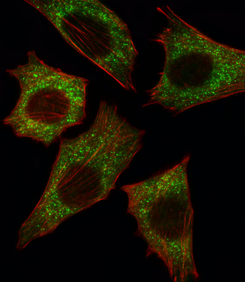 BRAF / B-Raf Antibody - Fluorescent image of C2C12 cell stained with BRAF Antibody. C2C12 cells were fixed with 4% PFA (20 min), permeabilized with Triton X-100 (0.1%, 10 min), then incubated with BRAF primary antibody (1:25, 1 h at 37°C). For secondary antibody, Alexa Fluor 488 conjugated donkey anti-rabbit antibody (green) was used (1:400, 50 min at 37°C). Cytoplasmic actin was counterstained with Alexa Fluor 555 (red) conjugated Phalloidin (7units/ml, 1 h at 37°C). BRAF immunoreactivity is localized to Cytoplasm significantly.