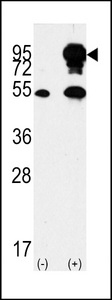 BRAF / B-Raf Antibody - Western blot of BRAF Antibody polyclonal antibody(arrow). 293 cell lysates (2 ug/lane) either nontransfected (Lane 1) or transiently transfected with the BRAF gene (Lane 2) (Origene Technologies).