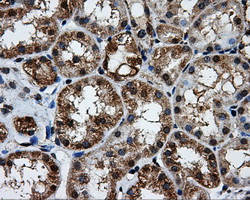 BRAF / B-Raf Antibody - Immunohistochemical staining of paraffin-embedded Kidney tissue using anti-BRAF mouse monoclonal antibody. (Dilution 1:50).