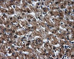 BRAF / B-Raf Antibody - Immunohistochemical staining of paraffin-embedded liver tissue using anti-BRAF mouse monoclonal antibody. (Dilution 1:50).