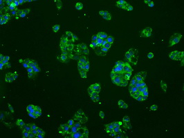 BRAF / B-Raf Antibody - Immunofluorescent staining of HepG2 cells using anti-BRAF mouse monoclonal antibody.
