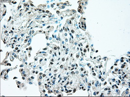 BRAF / B-Raf Antibody - IHC of paraffin-embedded lung tissue using anti-BRAF mouse monoclonal antibody. (Dilution 1:50).