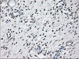 BRAF / B-Raf Antibody - IHC of paraffin-embedded Ovary tissue using anti-BRAF mouse monoclonal antibody. (Dilution 1:50).