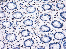 BRAF / B-Raf Antibody - IHC of paraffin-embedded colon tissue using anti-BRAF mouse monoclonal antibody. (Dilution 1:50).