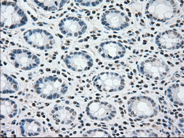 BRAF / B-Raf Antibody - IHC of paraffin-embedded Human colon tissue using anti-BRAF mouse monoclonal antibody.