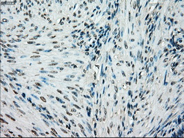 BRAF / B-Raf Antibody - IHC of paraffin-embedded endometrium tissue using anti-BRAF mouse monoclonal antibody. (Dilution 1:50).