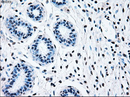 BRAF / B-Raf Antibody - IHC of paraffin-embedded breast tissue using anti-BRAF mouse monoclonal antibody. (Dilution 1:50).