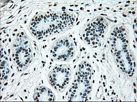 BRAF / B-Raf Antibody - IHC of paraffin-embedded breast tissue using anti-BRAF mouse monoclonal antibody. (Dilution 1:50).