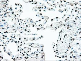 BRAF / B-Raf Antibody - IHC of paraffin-embedded lung tissue using anti-BRAF mouse monoclonal antibody. (Dilution 1:50).