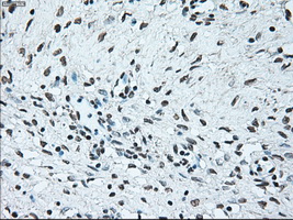 BRAF / B-Raf Antibody - IHC of paraffin-embedded Ovary tissue using anti-BRAF mouse monoclonal antibody. (Dilution 1:50).