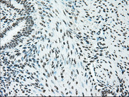 BRAF / B-Raf Antibody - IHC of paraffin-embedded endometrium tissue using anti-BRAF mouse monoclonal antibody. (Dilution 1:50).