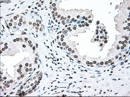 BRAF / B-Raf Antibody - IHC of paraffin-embedded prostate tissue using anti-BRAF mouse monoclonal antibody. (Dilution 1:50).