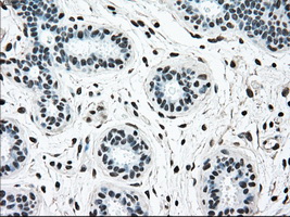 BRAF / B-Raf Antibody - IHC of paraffin-embedded breast tissue using anti-BRAF mouse monoclonal antibody. (Dilution 1:50).