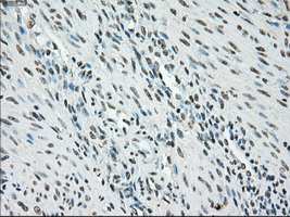 BRAF / B-Raf Antibody - IHC of paraffin-embedded endometrium tissue using anti-BRAF mouse monoclonal antibody. (Dilution 1:50).