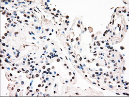 BRAF / B-Raf Antibody - IHC of paraffin-embedded Human lung tissue using anti-BRAF mouse monoclonal antibody.