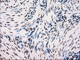 BRAF / B-Raf Antibody - IHC of paraffin-embedded Human endometrium tissue using anti-BRAF mouse monoclonal antibody.