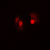 BRAF / B-Raf Antibody - Immunofluorescent analysis of B-RAF staining in A431 cells. Formalin-fixed cells were permeabilized with 0.1% Triton X-100 in TBS for 5-10 minutes and blocked with 3% BSA-PBS for 30 minutes at room temperature. Cells were probed with the primary antibody in 3% BSA-PBS and incubated overnight at 4 C in a humidified chamber. Cells were washed with PBST and incubated with a DyLight 594-conjugated secondary antibody (red) in PBS at room temperature in the dark. DAPI was used to stain the cell nuclei (blue).