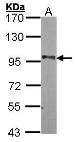 BRAF / B-Raf Antibody - Sample (30 ug of whole cell lysate). A: A549 7.5% SDS PAGE. BRAF antibody diluted at 1:1000. 