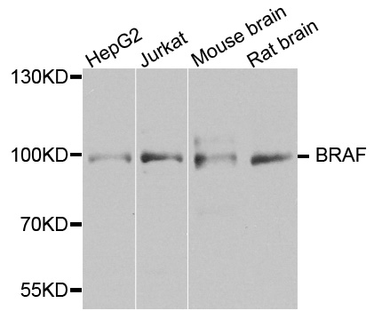BRAF / B-Raf Antibody - Western blot analysis of extracts of various cell lines, using BRAF antibody at 1:1000 dilution. The secondary antibody used was an HRP Goat Anti-Rabbit IgG (H+L) at 1:10000 dilution. Lysates were loaded 25ug per lane and 3% nonfat dry milk in TBST was used for blocking. An ECL Kit was used for detection and the exposure time was 90s.