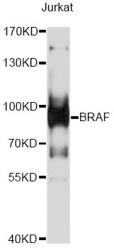 BRAF / B-Raf Antibody - Western blot analysis of extracts of Jurkat cells, using BRAF antibody at 1:1000 dilution. The secondary antibody used was an HRP Goat Anti-Rabbit IgG (H+L) at 1:10000 dilution. Lysates were loaded 25ug per lane and 3% nonfat dry milk in TBST was used for blocking. An ECL Kit was used for detection and the exposure time was 15s.