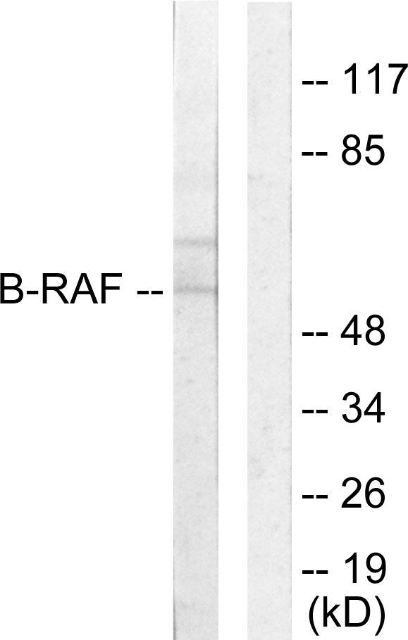 BRAF / B-Raf Antibody - Western blot analysis of extracts from HeLa cells, using B-RAF antibody.