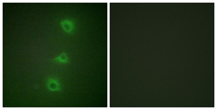 BRAF / B-Raf Antibody - Peptide - + Immunofluorescence analysis of HUVEC cells, using B-RAF antibody.