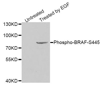 BRAF / B-Raf Antibody - Western blot analysis of extracts of HeLa cells.