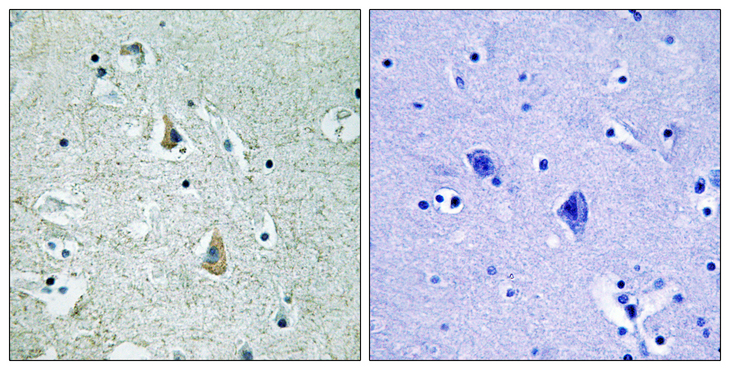BRAF / B-Raf Antibody - Immunohistochemistry analysis of paraffin-embedded human brain, using B-RAF (Phospho-Ser446) Antibody. The picture on the right is blocked with the phospho peptide.