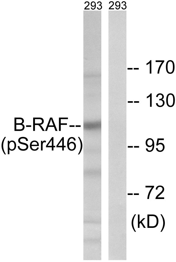 BRAF / B-Raf Antibody - Western blot analysis of lysates from 293 cells treated with EGF 200ng/ml 30', using B-RAF (Phospho-Ser446) Antibody. The lane on the right is blocked with the phospho peptide.
