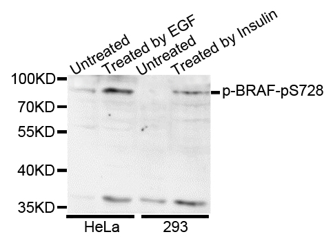 BRAF / B-Raf Antibody - Western blot analysis of extracts of various cell lines.