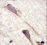 BRAF / B-Raf Antibody - Formalin-fixed and paraffin-embedded human brain tissue reacted with BRAF Antibody (S602) , which was peroxidase-conjugated to the secondary antibody, followed by DAB staining. This data demonstrates the use of this antibody for immunohistochemistry; clinical relevance has not been evaluated.