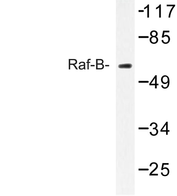 BRAF / B-Raf Antibody - Western blot of Raf-B (Y198) pAb in extracts from HeLa cells.