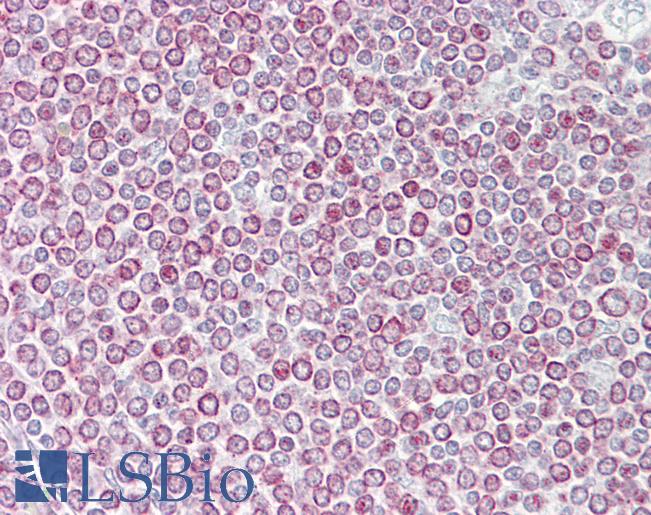 BRAK / CXCL14 Antibody - Anti-CXCL14 antibody IHC of human spleen. Immunohistochemistry of formalin-fixed, paraffin-embedded tissue after heat-induced antigen retrieval. Antibody concentration 5 ug/ml.  This image was taken for the unconjugated form of this product. Other forms have not been tested.