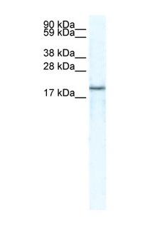 BRAK / CXCL14 Antibody - CXCL14 antibody Western blot of skeletal muscle lysate. Antibody concentration 5 ug/ml. This image was taken for the unconjugated form of this product. Other forms have not been tested.