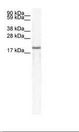 BRAK / CXCL14 Antibody - Fetal Skeletal Muscle Lysate.  This image was taken for the unconjugated form of this product. Other forms have not been tested.