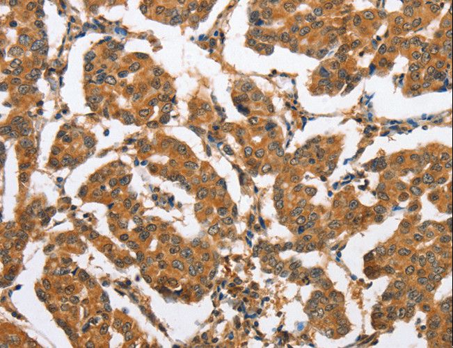 BRAK / CXCL14 Antibody - Immunohistochemistry of paraffin-embedded Human brain using CXCL14 Polyclonal Antibody at dilution of 1:60.