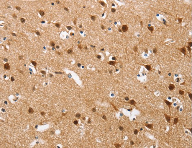 BRAK / CXCL14 Antibody - Immunohistochemistry of paraffin-embedded Human brain using CXCL14 Polyclonal Antibody at dilution of 1:60.