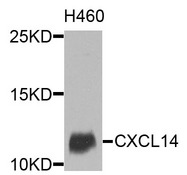 BRAK / CXCL14 Antibody - Western blot analysis of extracts of various cells.