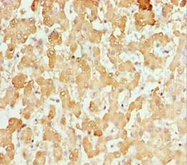 BRAK / CXCL14 Antibody - Immunohistochemistry of paraffin-embedded human liver tissue at dilution 1:100