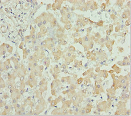 BRAK / CXCL14 Antibody - Immunohistochemistry of paraffin-embedded human liver tissue at dilution 1:100