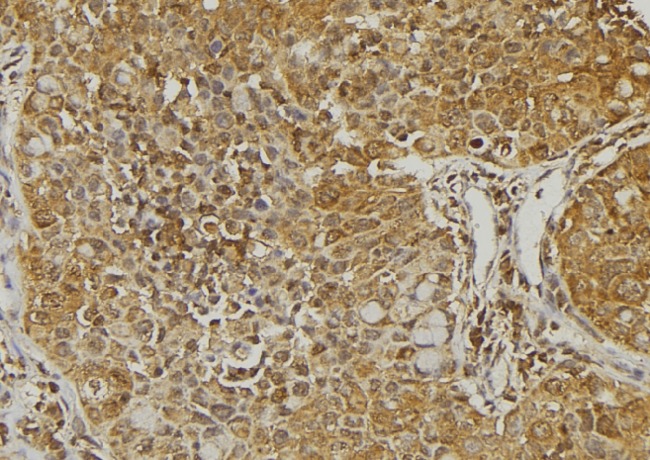 BRAK / CXCL14 Antibody - 1:100 staining human pancreas tissue by IHC-P. The sample was formaldehyde fixed and a heat mediated antigen retrieval step in citrate buffer was performed. The sample was then blocked and incubated with the antibody for 1.5 hours at 22°C. An HRP conjugated goat anti-rabbit antibody was used as the secondary.